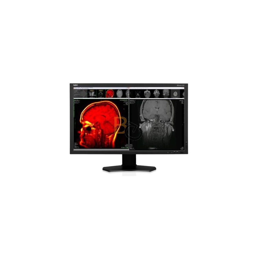 Monitor NEC MDview 243